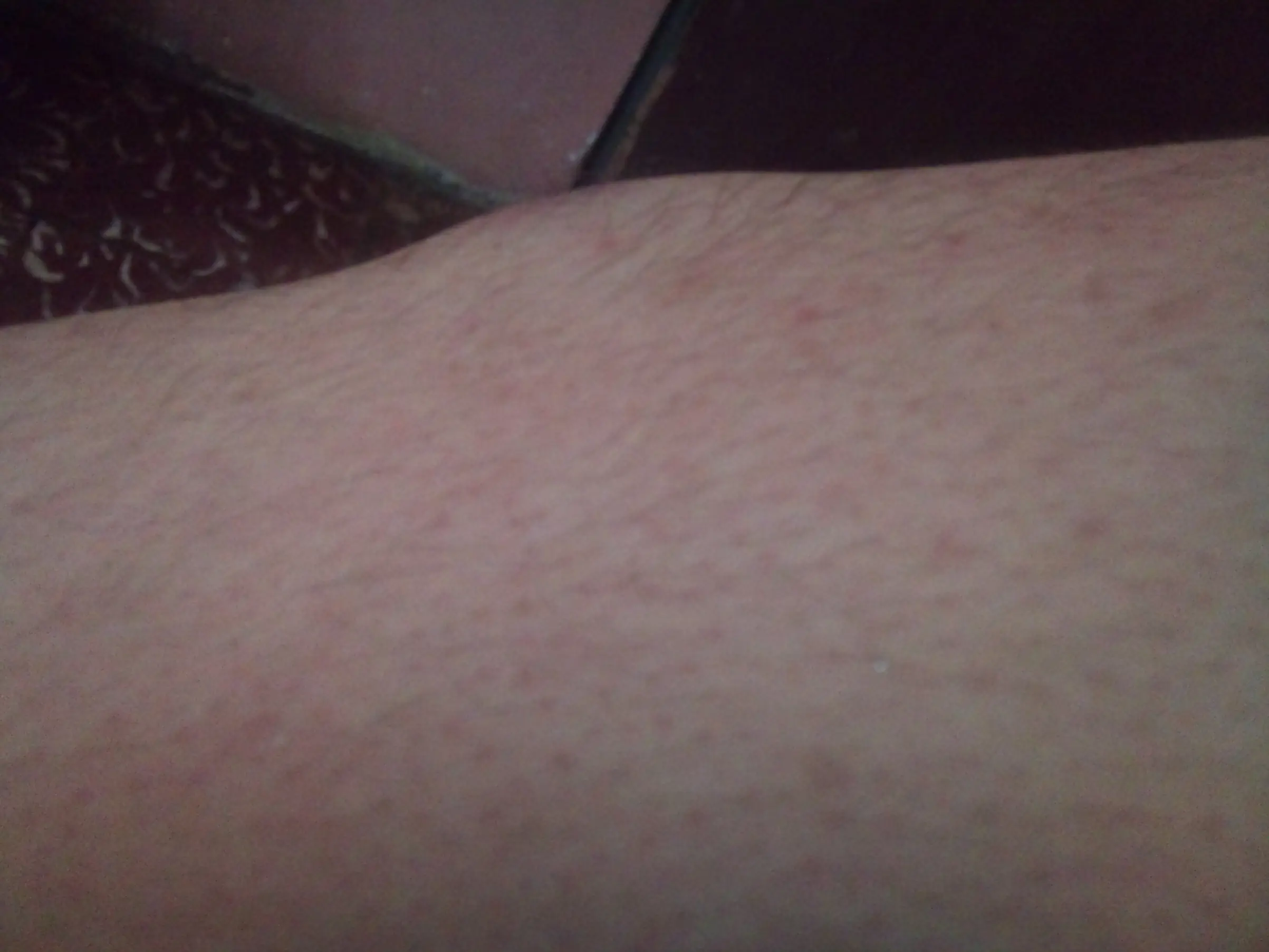 Golpes en la japierna