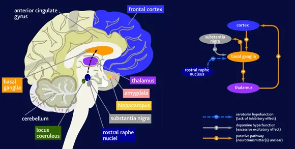 Esto es lo que le pasa al cerebro si no duermes