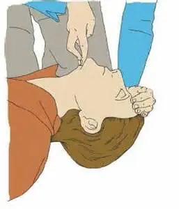 Salvate una vida: Paro cardiaco