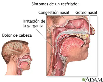 resfriado