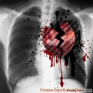 Síndrome del corazón roto...interesante