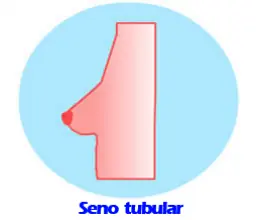 senos, senos y más senos.