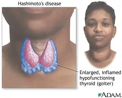 Adrenal Adrenal