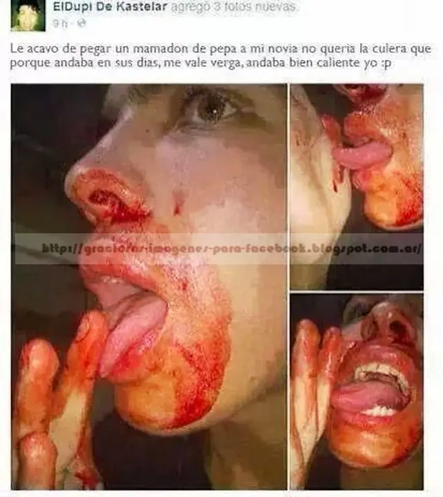 imagenes