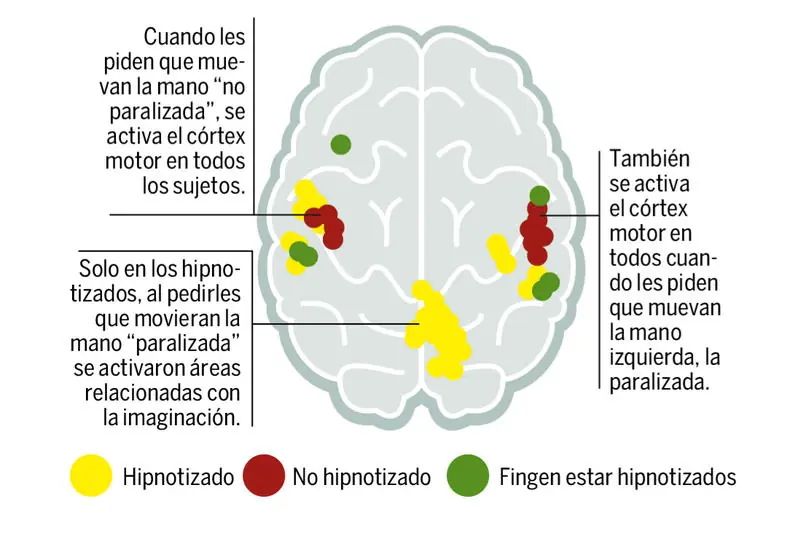 hipnosis