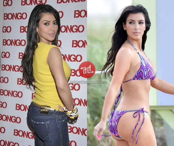 10 famosas antes y despues de que se hagan la cola