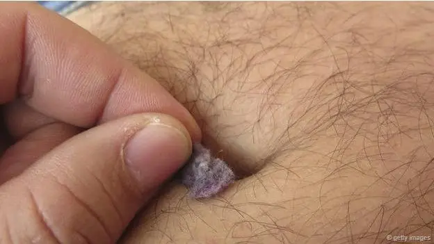 pelusa pelusa