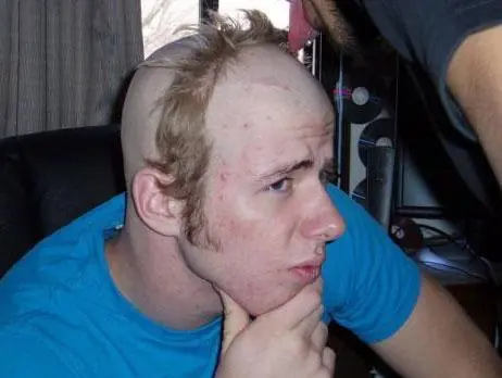 pelo