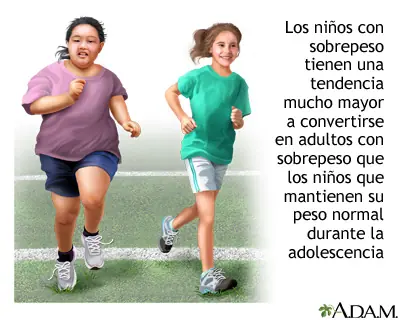 La obesidad.