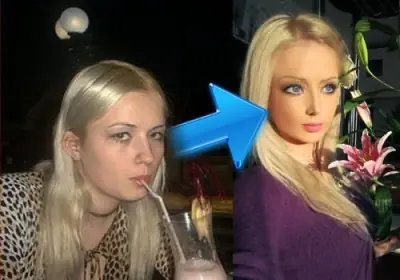 El antes y el después de las 4 barbies humanas más famosas.