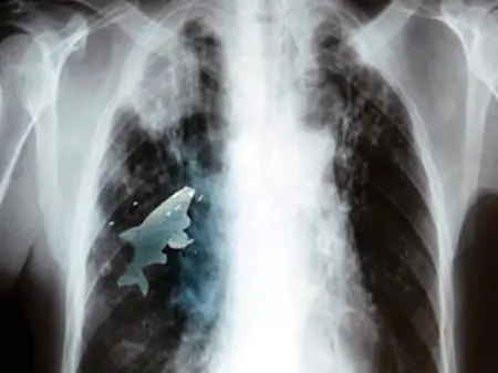 Queres Sorprenderte?.. Entra!