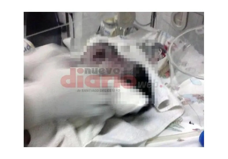 Nace bebe con dos cabezas en Santiago del Estero!