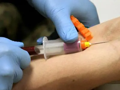 ¿Cómo se conserva la sangre?