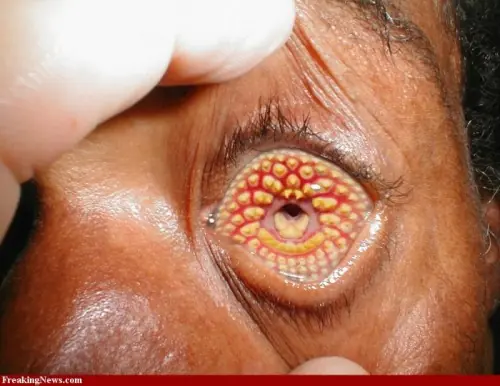 tropofobia