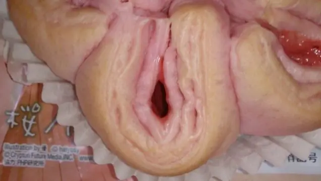 Vaginas