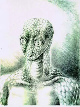 manoplaszt