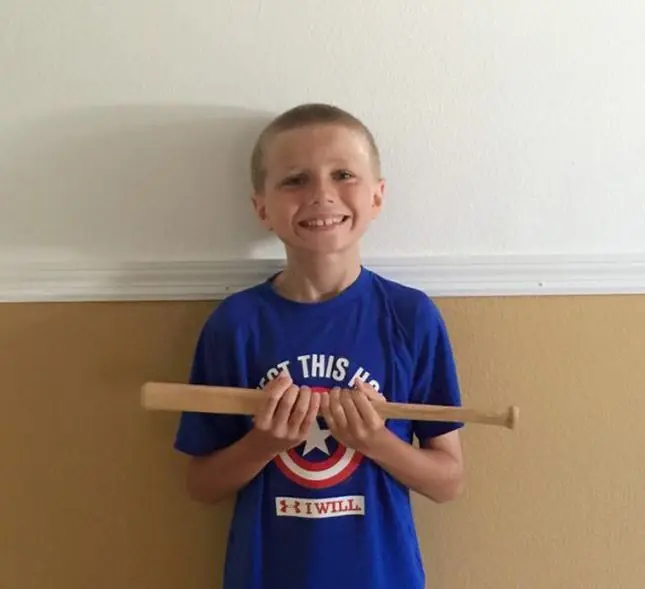 Se dejo crecer el pelo para ayudar a niños enfermos