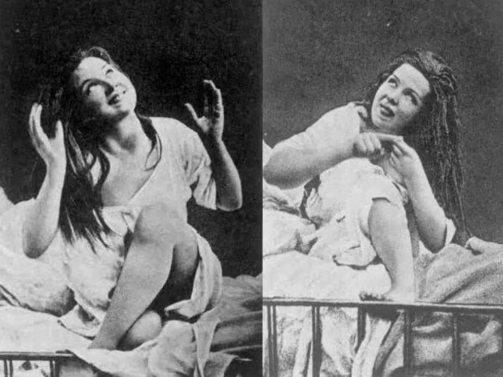 Raras enfermedades que afectaba solo a mujeres en sigloXIX