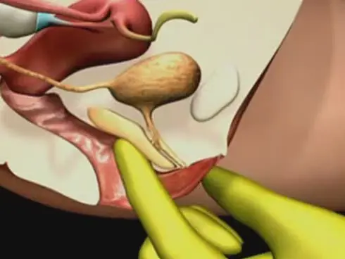 Aprende de sexo!