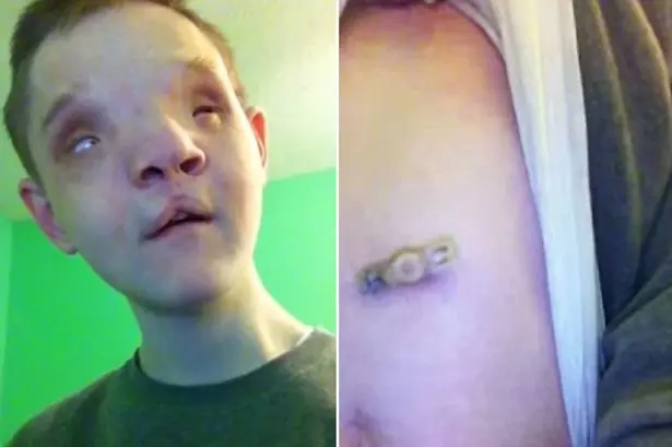 "Amo la vida porque siempre podría ser peor"