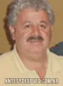 Famosos antes y despues variadito(mas)