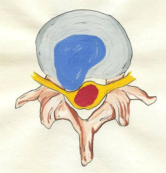 Libro sobre Endoscopia de Columna