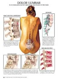columna vertebral