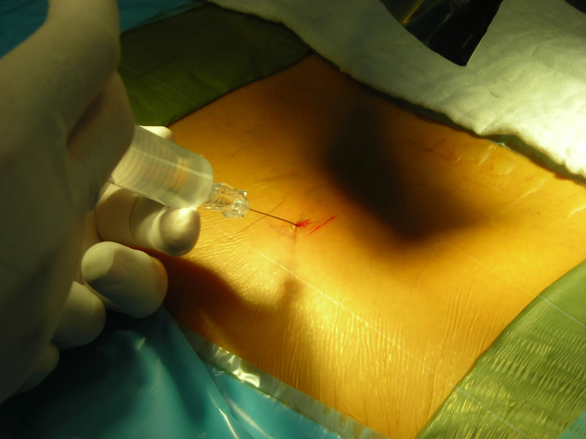 endoscopia