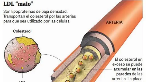 Avance Contra el Colesterol