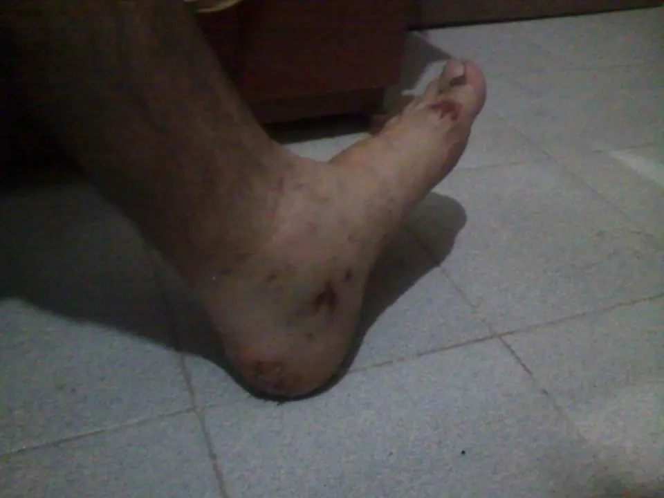 me chocaron la moto