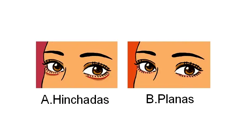 ojeras