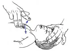 revivir