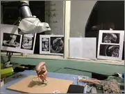 fetal