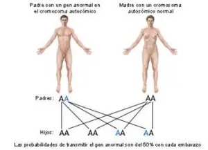 Una pareja normal puede tener un hijo enano ? Una pareja normal puede tener un hijo enano ?