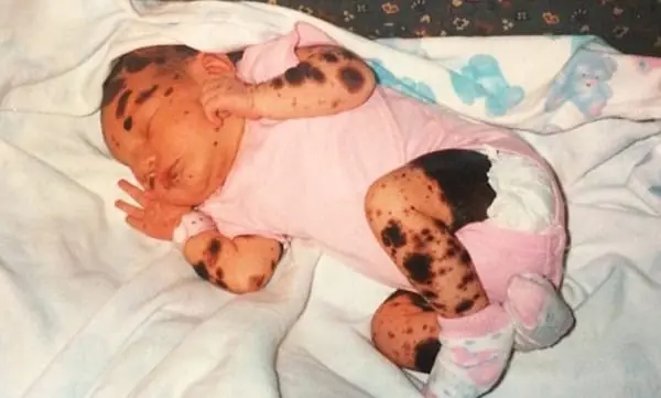 De chica le decian “perra pecosa”