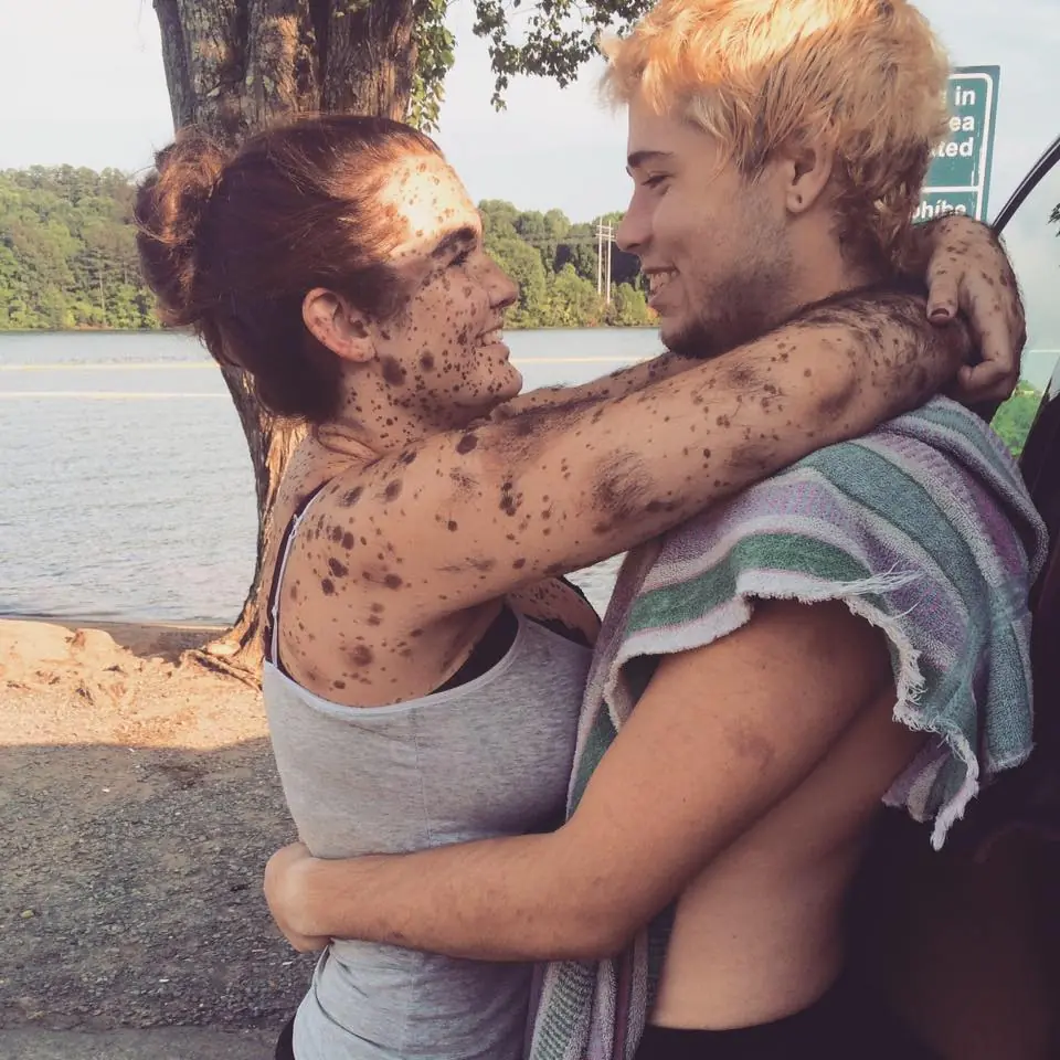 De chica le decian “perra pecosa”