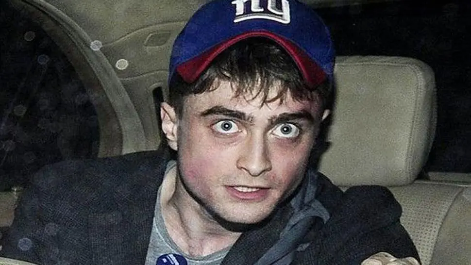 El actor de Harry Potter se muestra muy demacrado