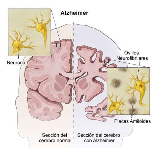 cognitiva