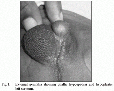 Top las 18 anomalias medicas mas extrañas del mundo :)