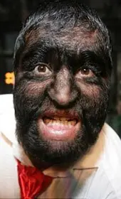 Top las 18 anomalias medicas mas extrañas del mundo :)