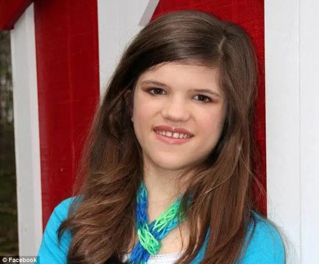 Top las 18 anomalias medicas mas extrañas del mundo :)