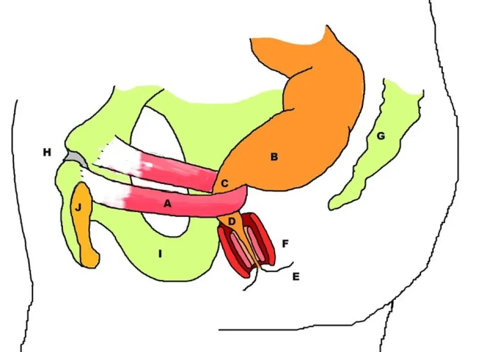 Como