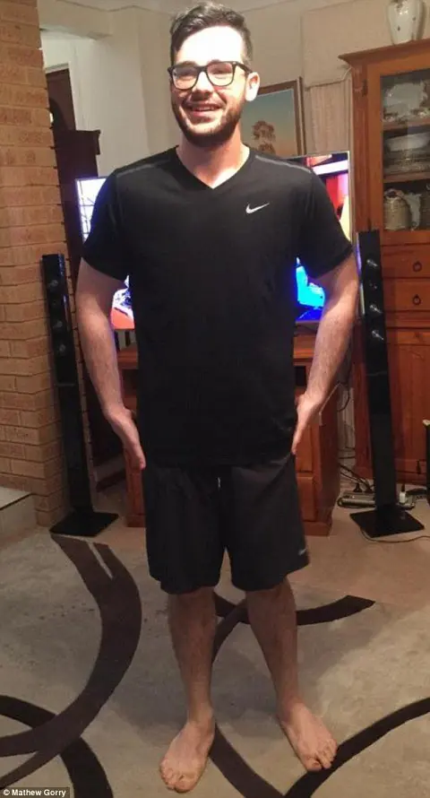 Pesaba 155 kilos y no salía de su casa por vergüenza Pesaba 155 kilos y no salía de su casa por vergüenza