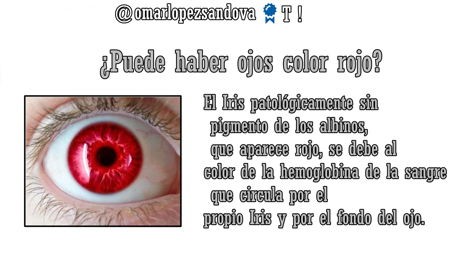 ¡21 Curiosidades del ojo humano!