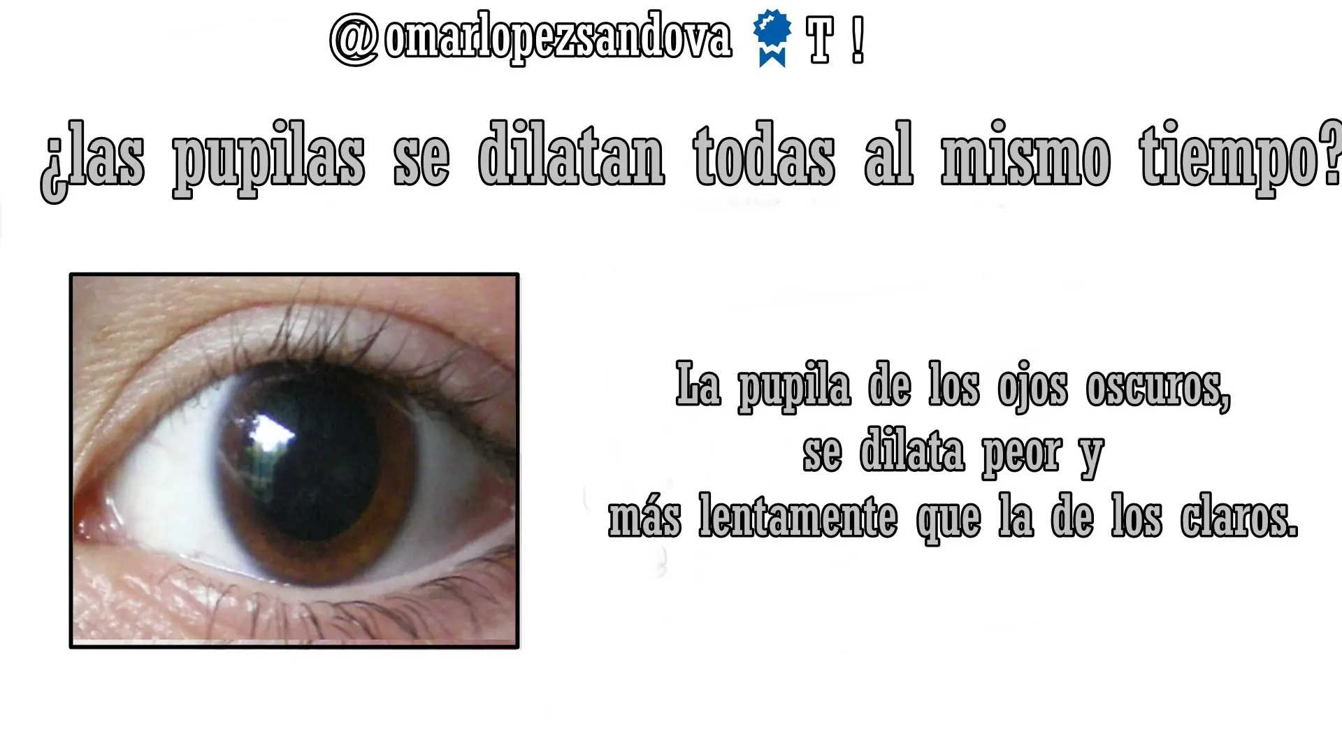 ojos
