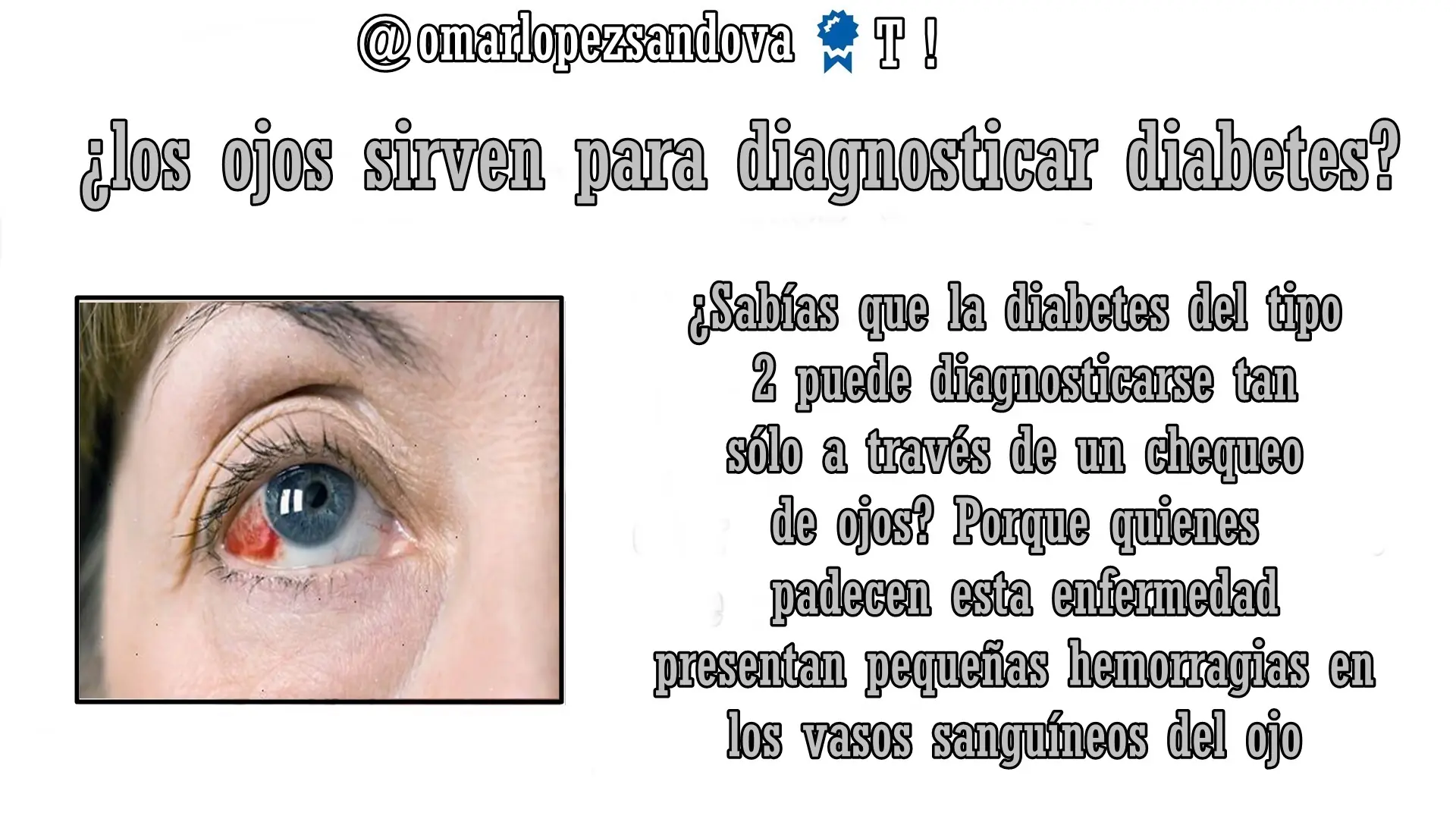 humano