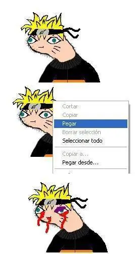 imagenes