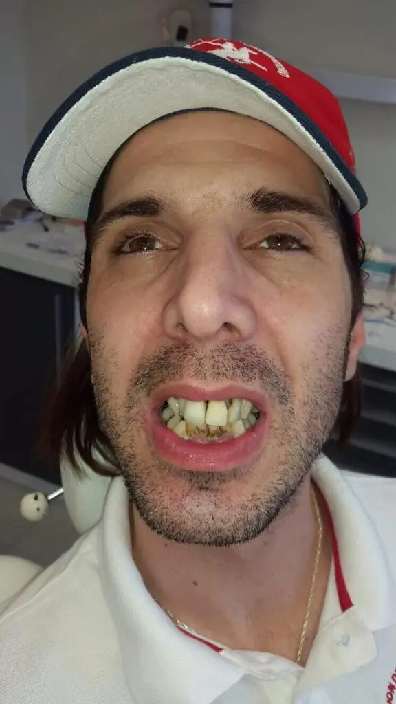 Mirá cómo le quedó la dentadura al gigoló.....