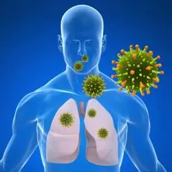 virus