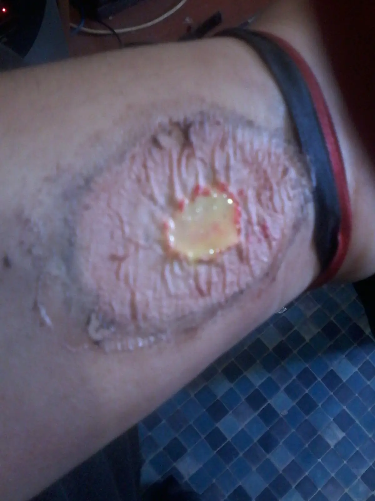 sangre